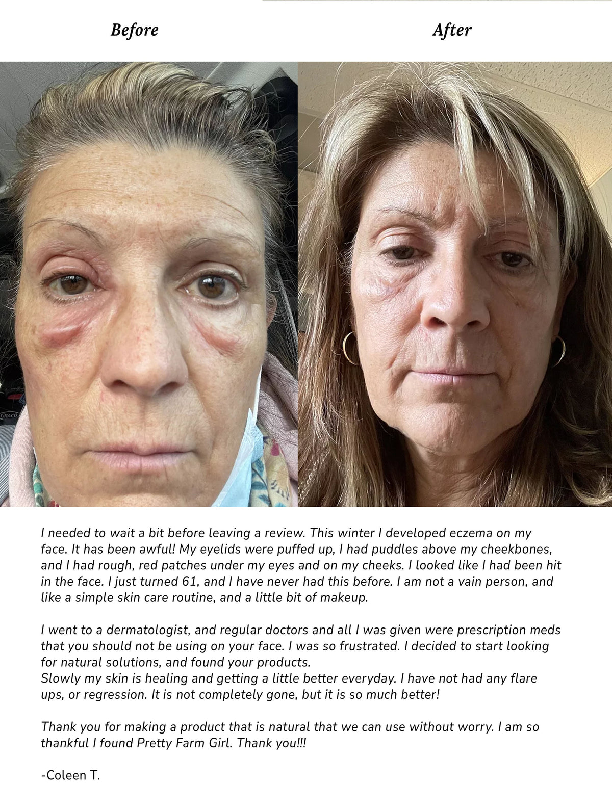 Simple Skin Kit For Sensitive Skin