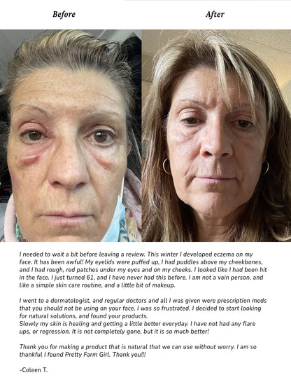 Simple Skin Kit For Sensitive Skin